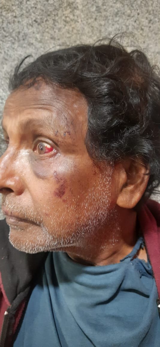 *तृणमूल पार्षद पति पर गुंडागर्दी का आरोप, केयरटेकर की पिटाई का वीडियो वायरल*